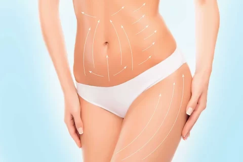 Radiofrequency Treatment